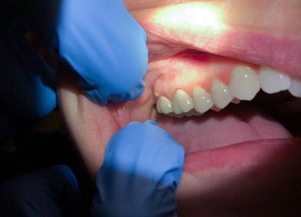 Best Emergency Gum Pain Relief  in Boley, OK